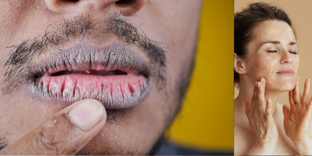 men with dry skin